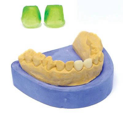 BURN Dental Casting Resin 5