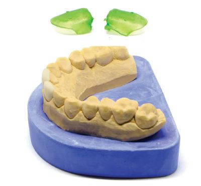 BURN Dental Casting Resin 4